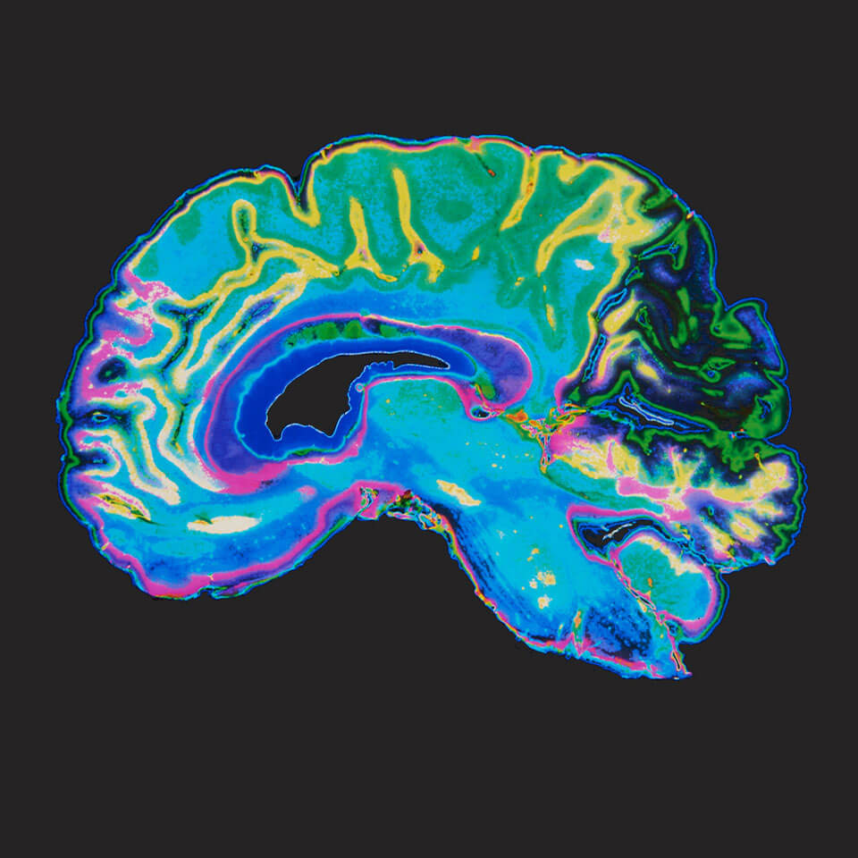 Mitarbeitermagazin «Forum» Bildausschnitt